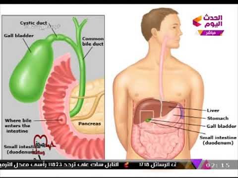 استشاري جراحة عامة يكشف الدور السحري الذي تقوم به المرارة بجسم الإنسان
