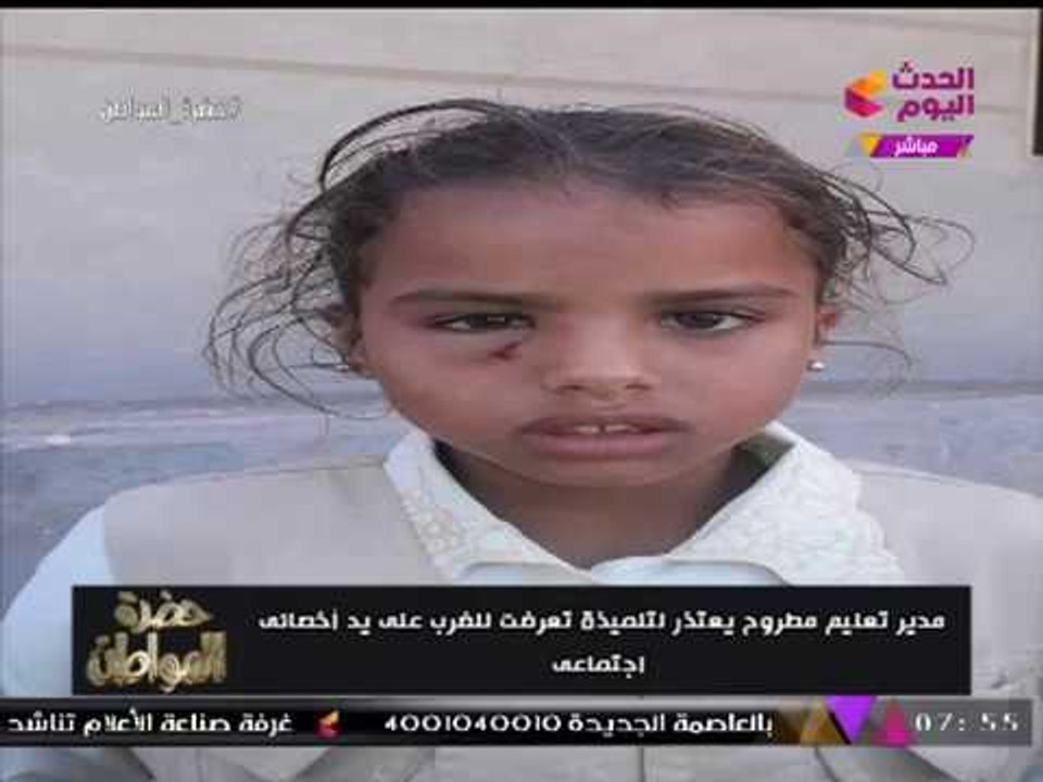 أخصائي اجتماعي يتسبب في إصابة بالغة لطالبة بمطروح ومدير التعليم يعتذر لها