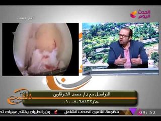 مع الشعب مع أحمد المغربل| "الرباط الصليبي" مع د. محمد الشرقاوي استشاري جراحة العظام 30-10-2017