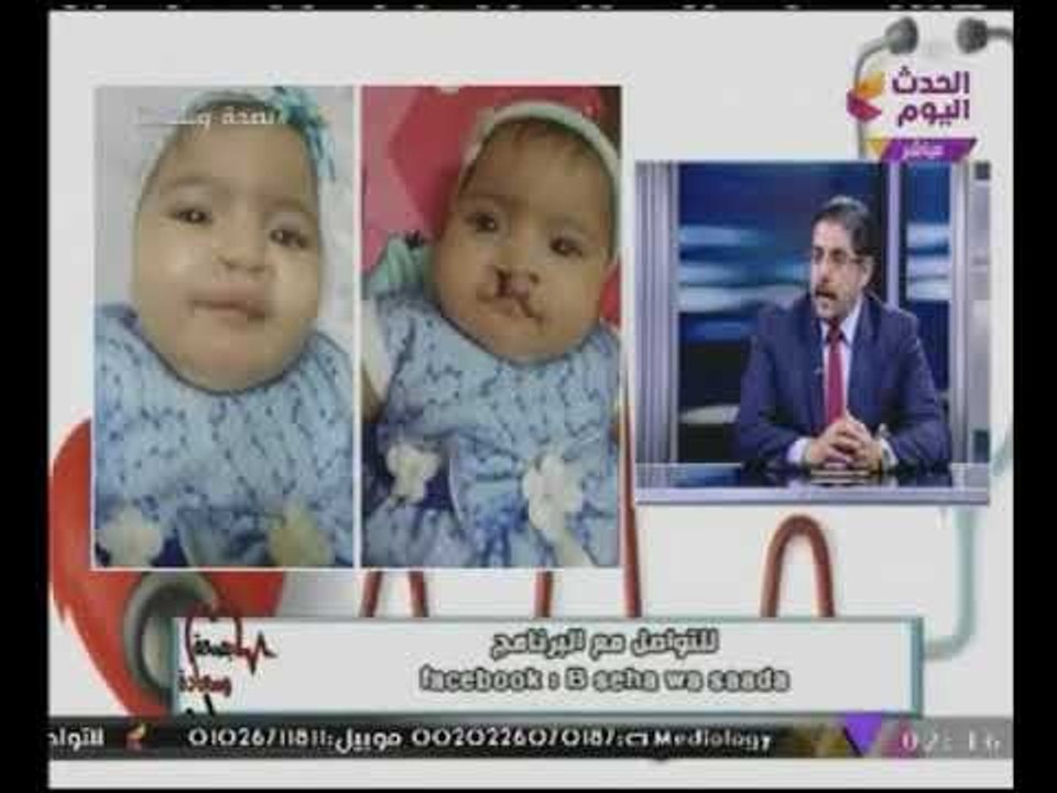 بصحة وسعادة مع ساندر نشأت وبتول علاء| لقاء مع د. وائل غانم العيوب الخلقية للاطفال 1-11-2017