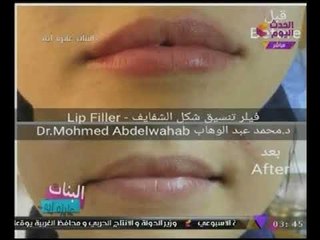 #بالصور دكتور "محمد عبدالوهاب" يوضح طريقة تنسيق شكل الشفايف عند #السيدات