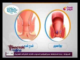 دكتور اون لاين مع سلوى عبد الغفار| لقاء د.أحمد إبراهيم استشاري الجراحة العامة وجراحات الشرج 6-2-2018