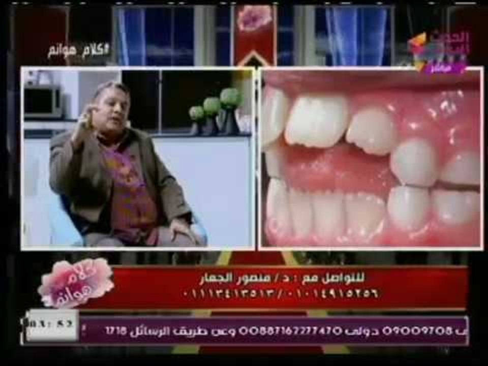 برنامج كلام هوانم | ولقاء د. منصور الجعار استشاري تقويم الفم والاسنان  30-1-2018