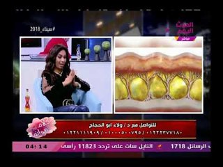 مفاجأة| د.ولاء أبو الحجاج تعلن عن"الهيفو" أحدث جهاز لعلاج التجاعيد والتليفات