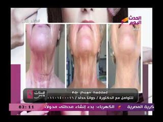 بالصور| تعرف علي طريقة مذهلة للقضاء علي الترهلات في نصف ساعة مع خبيرة تجميل