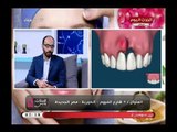 للستات وبس مع مني كمال| مع د.أحمد رافت اخصائي جراحة الوجه والفكين وزراعة الاسنان 2-5-2018