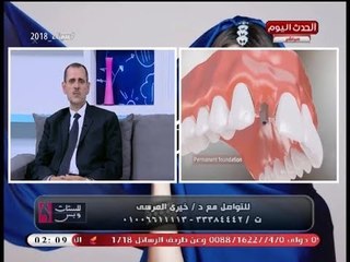 بالفيديو| استشاري جراحة فم ووجه وفكين يكشف عن بديل لتعويض فقد الأسنان