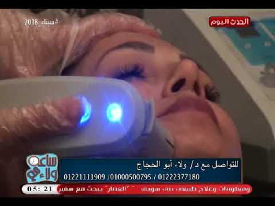 د ولاء ابو الحجاج وعمل جلسة باستخدام جهاز الهايفو لعلاج تجاعيد البشرة بدون حقن ونتيجة فى نفس الوقت
