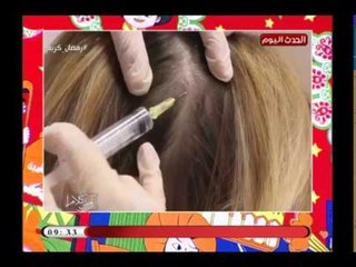 خبيرة التجميل د. ايمان محمود توضح الفرق بين الكرياتين والبروتين ومعرفة النوع الجيد