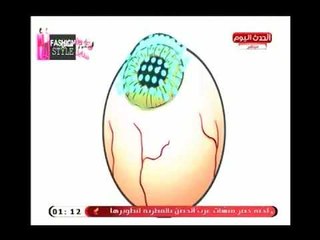 فاشون ستايل مع شيرين نبيل وعماد النمر|لقاء د.سامح ادوارد الببلاوي اخصائي جراحة العيون10-7-2018