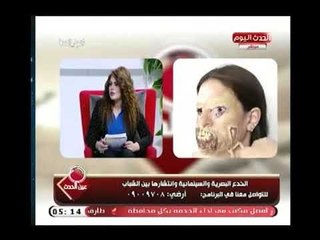 مصمم الخدع السينمائية "أدهم نور" يكشف عن المعوقات التي واجهته في مجاله وكيف تغلب عليها