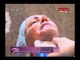 د.ولاء ابو الحجاج خلبيرة التجميل توضح طريقة استخدام جهاز "الهايفو" لعلاج تجاعيد البشرة