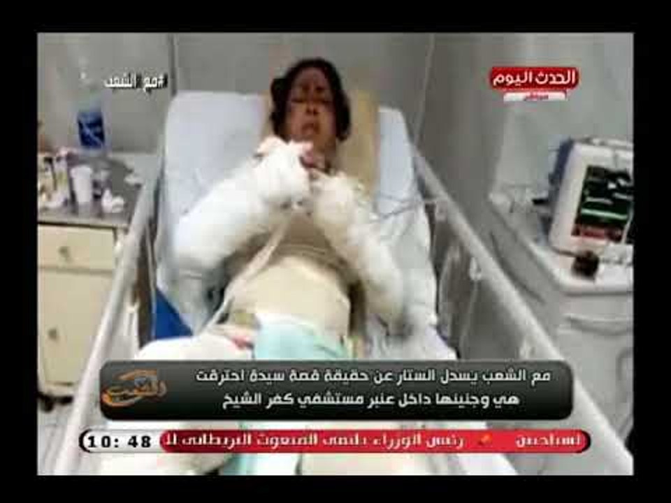 شاهد| احتراق سيدة وجنينها (18+) داخل مستشفي كفر الشيخ