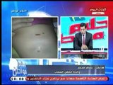 بعد نهش جسد نجلها .. والدة طفل المصاب تطالب عالهواء بالقضاء على الكلاب الضالة