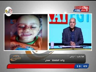 بالفيديو| أغرب حالة طبية في العالم طفلة تتعرق دماء من كل مناطق جسمها