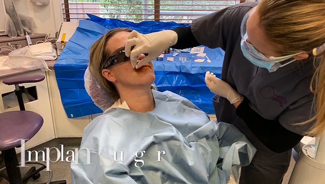 Dental Implants Surgery in Melbourne - Healthy Smiles