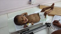 الأمم المتحدة تدق مجددا ناقوس خطر المجاعة في اليمن