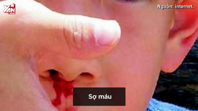 Giải Mã Nỗi Sợ: những nỗi ám ảnh làm bật lên tính cách của bạn