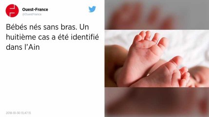 Bébés nés sans bras. Un huitième cas a été identifié dans l'Ain.