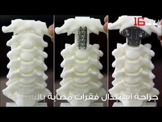 أفق جديد للعمليات الجراحية!