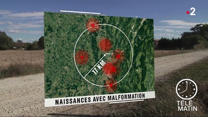 Bébés nés sans bras : 11 nouveaux cas recensés dans l'Ain