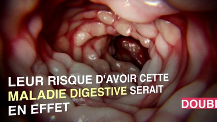 Les personnes atteintes de psoriasis seraient plus à risque de maladie de Crohn