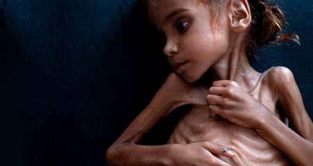 İç Savaşın Sembol İsmi Emel, Hayata Gözlerini Yumdu