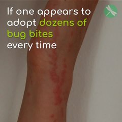 Here’s Why You’re A Mosquito Magnet