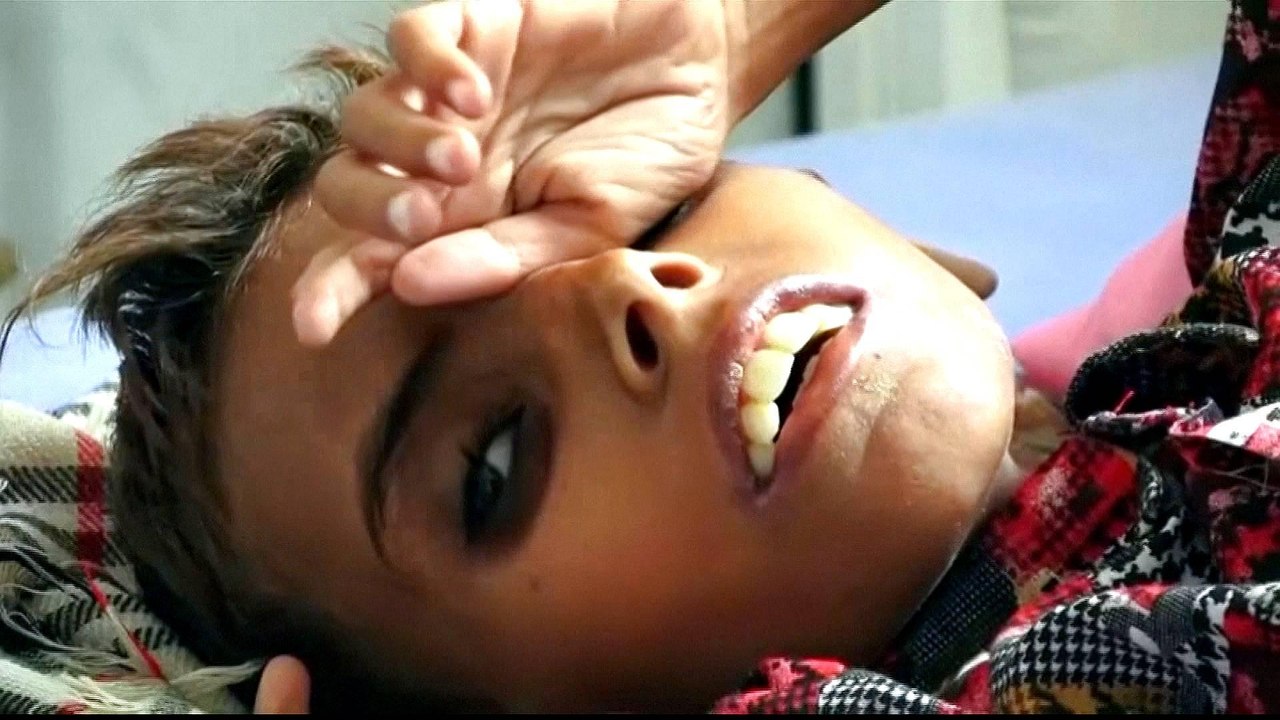 As Saudi-coalition expands Yemen war, UN says famine accelerating