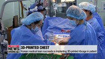 Korean medical team succeeds in implanting 3D-printed ribcage in patient