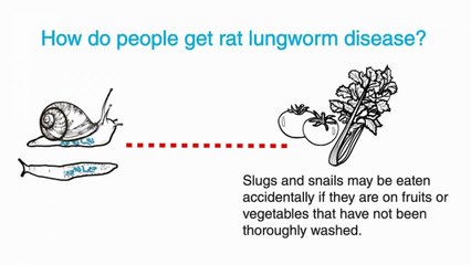 What Is Rat Lungworm?