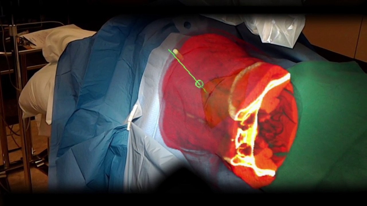 Santé : les prouesses de la chirurgie augmentée