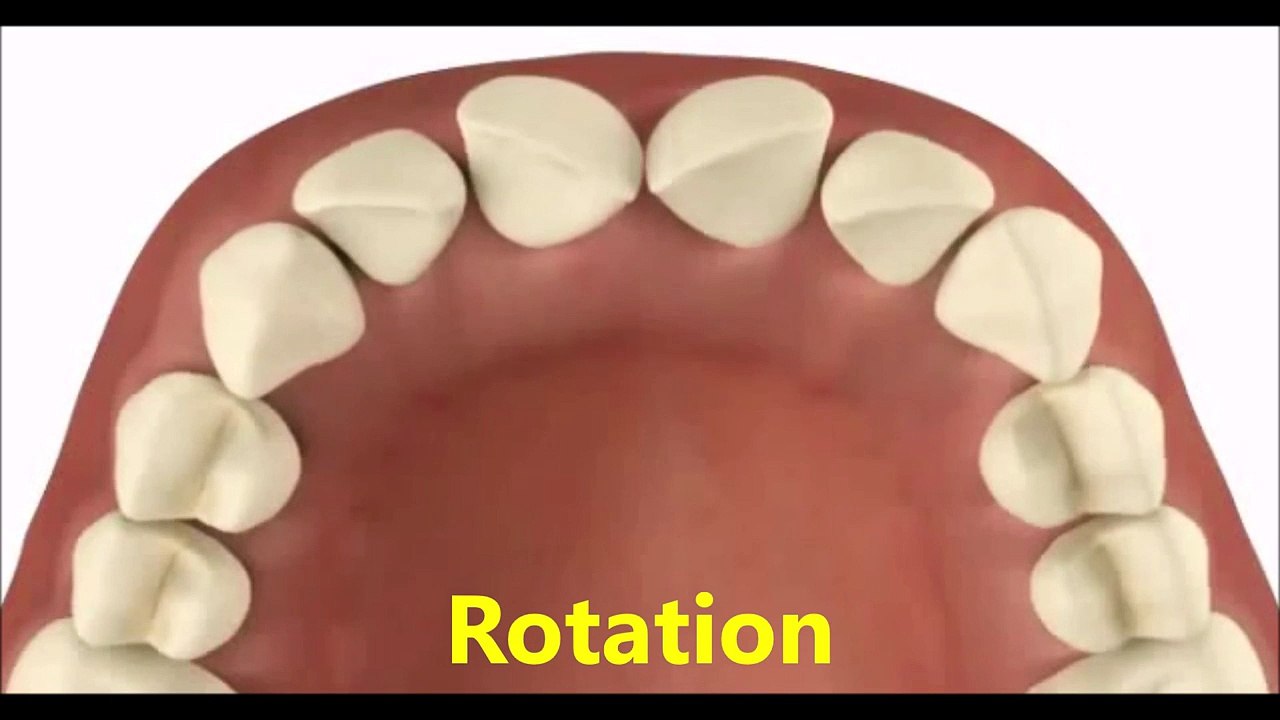 Dentist in Pasadena Texas