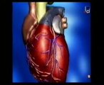Infarto de miocardio: Autopsia forense