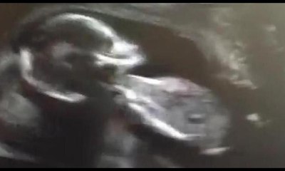 Kardeşini ultrasonda görünce bakın ne yaptı