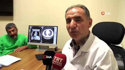 Adıyaman’lı Abuzer Ürkmez’in 4 Organı Ters Tarafta Bulunuyor