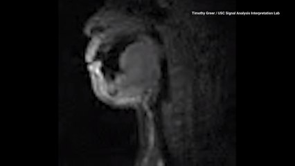 Watch People Beatbox in an MRI in Incredible Real-Time Video