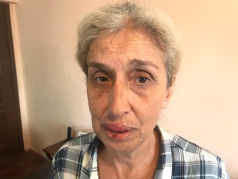 Sokak Hayvanlarını Beslerken Başka Kadınların Saldırısına Uğradı