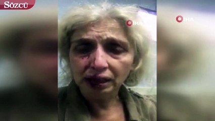 Sokak hayvanlarını beslerken başka kadınların saldırısına uğradı