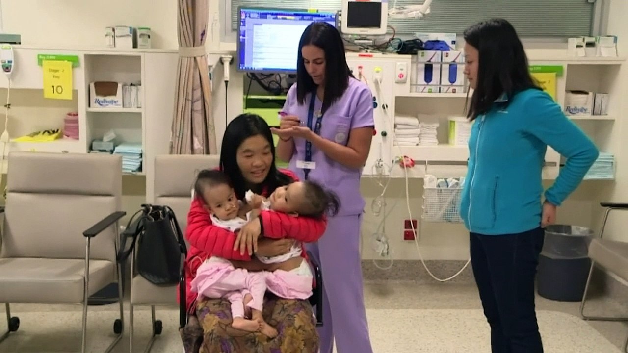 Conjoined twin girls successfully separated in Melbourne
