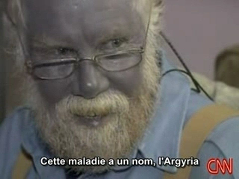 L'homme Schtroumpf, Paul Karason