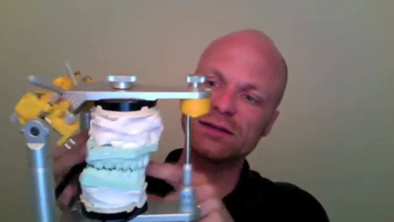 Wofür dient der Artikulator beim Zahnarzt