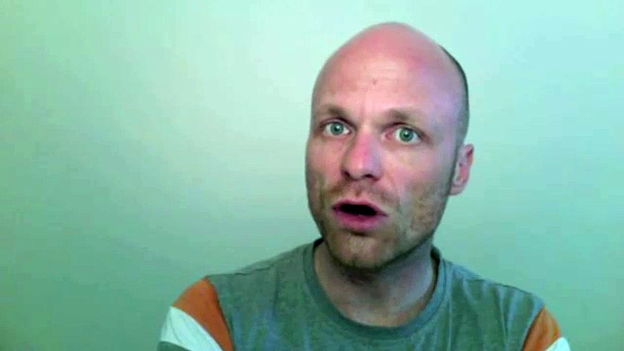 Gibt es eine Titanallergie