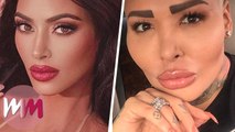 Top 10 People Who Abused Plastic Surgery to Look Like Their Idol