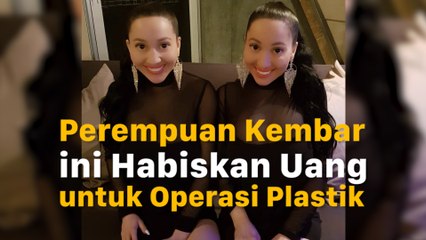 Wow! Kembar Identik ini Sangat Mirip