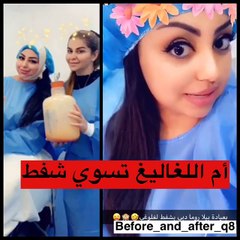 السعودية ريماس منصور تخضع لعملية تجميل غريبة.. وهكذا أصبح شكلها الآن