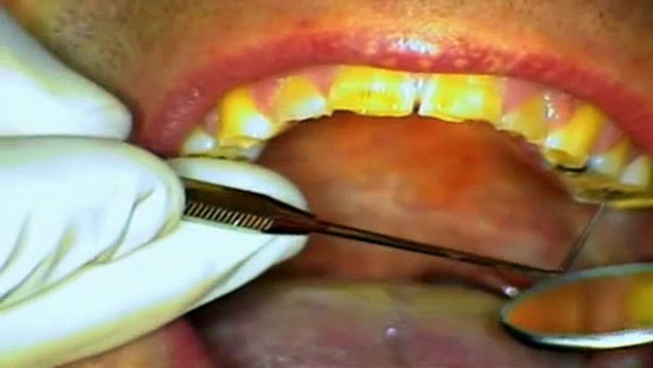 Embarrassing Bodies S03 E11