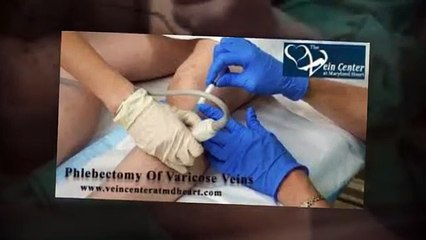 Vein Specialists