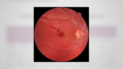 Brain-Healthy Foods to Fight Aging