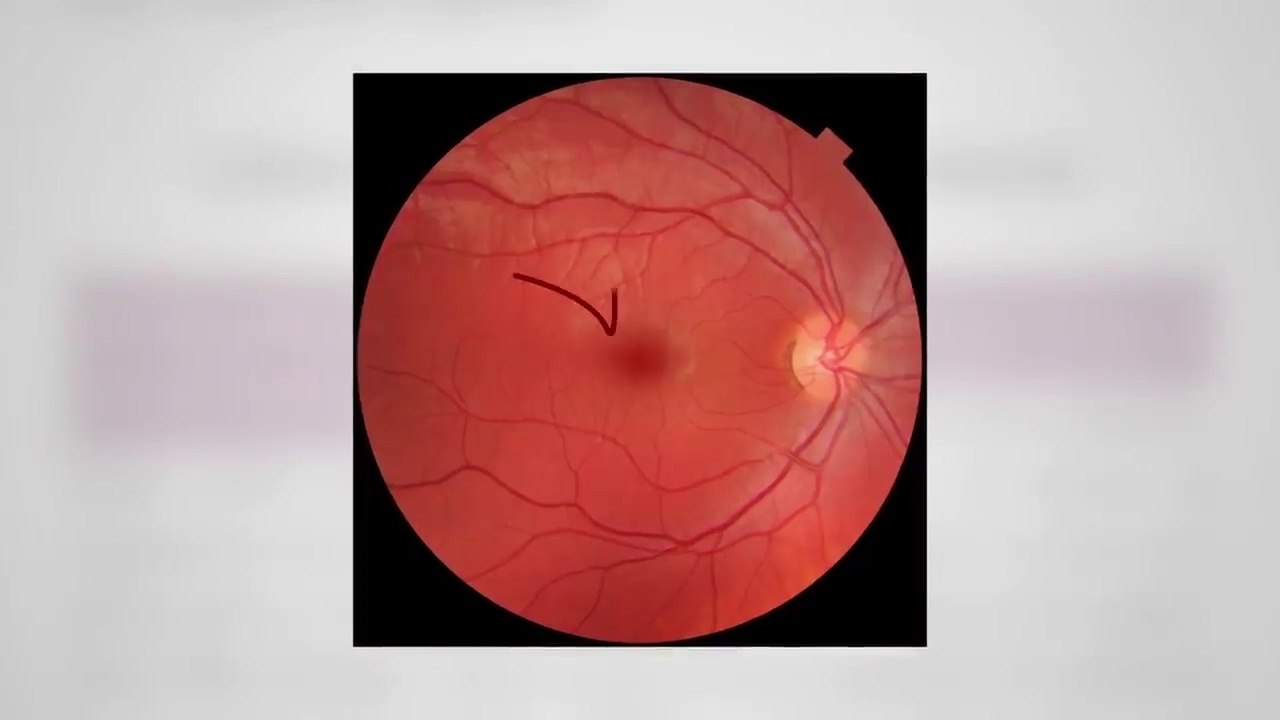 Brain-Healthy Foods to Fight Aging